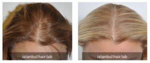 istanbul hair lab