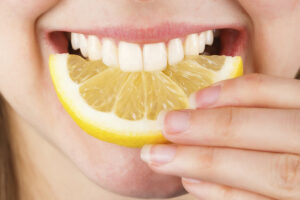 Lee más sobre el artículo Métodos fáciles de blanqueamiento dental en el hogar
