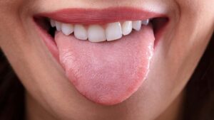 Lee más sobre el artículo ¿Qué es la boca seca?  ¿Por que sucede?